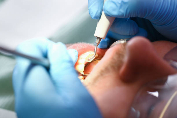 Best Emergency Treatment for Dental Infections or Abscesses in Lucas, TX