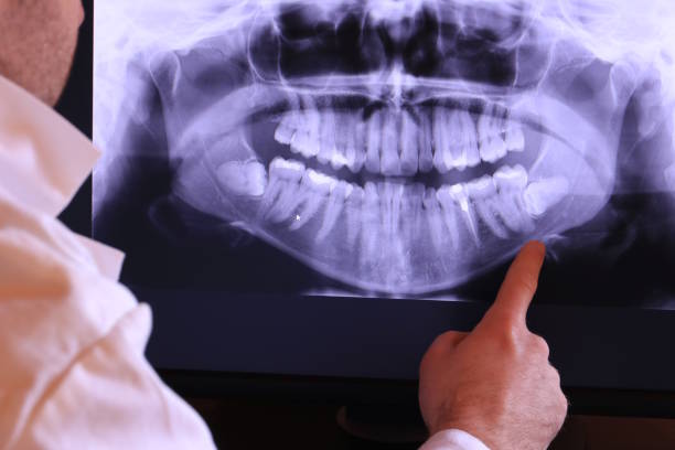 Best Emergency Dental Care for Broken or Chipped Teeth in Lucas, TX